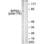 Western Blot - Anti-RIPK2 (phospho Ser176) Antibody (A8180) - Antibodies.com