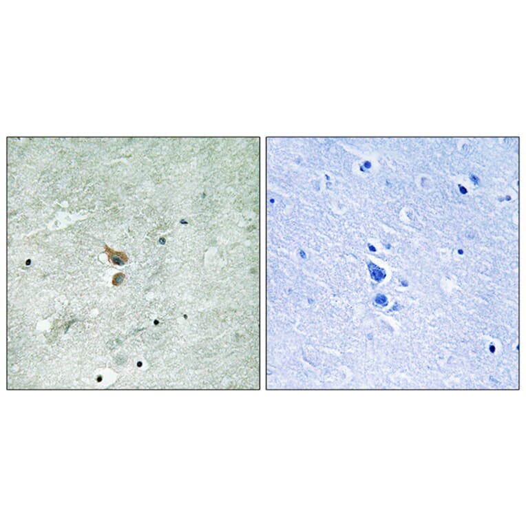 Immunohistochemistry - Anti-RIPK2 (phospho Ser176) Antibody (A8180) - Antibodies.com