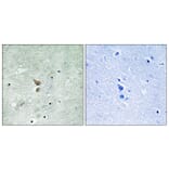 Immunohistochemistry - Anti-RIPK2 (phospho Ser176) Antibody (A8180) - Antibodies.com