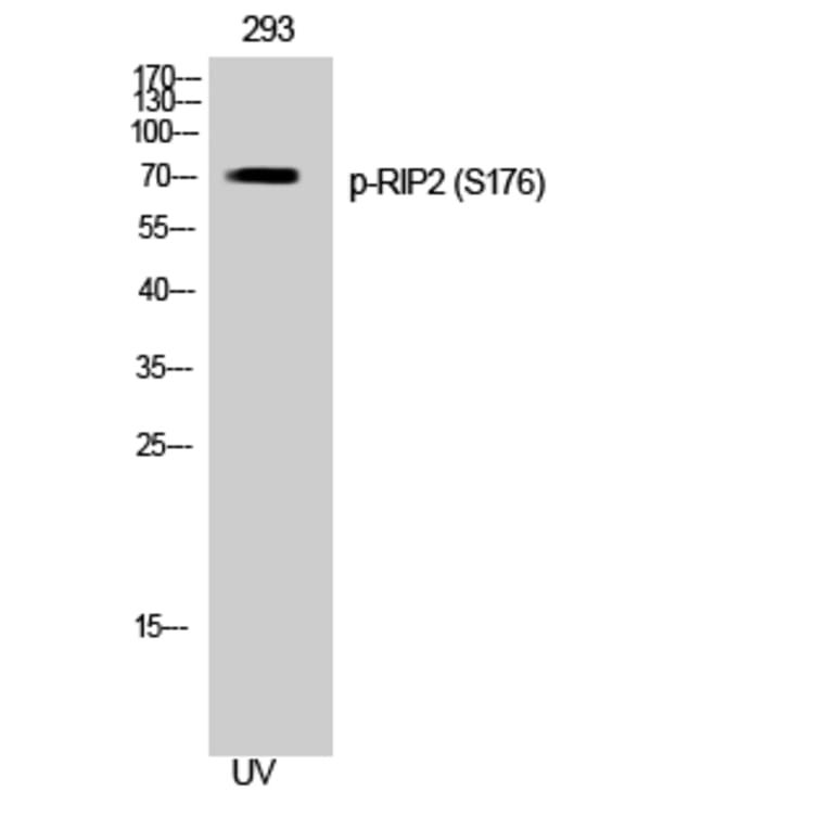 Western Blot - Anti-RIPK2 (phospho Ser176) Antibody (A8180) - Antibodies.com