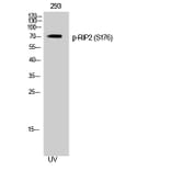 Western Blot - Anti-RIPK2 (phospho Ser176) Antibody (A8180) - Antibodies.com