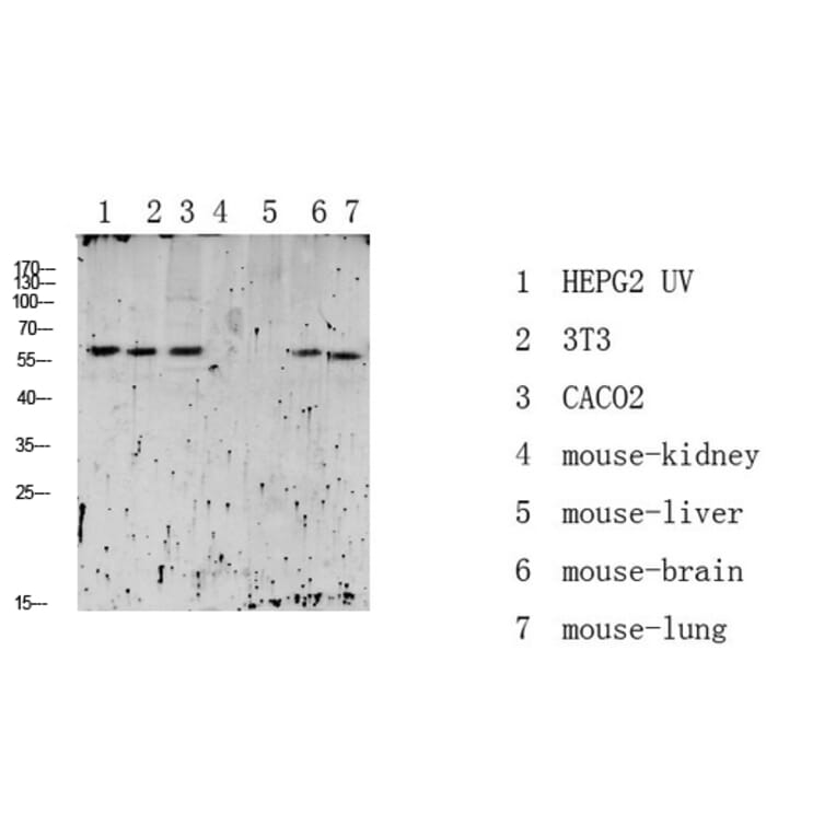 Western Blot - Anti-RIPK2 (phospho Ser176) Antibody (A8180) - Antibodies.com