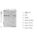 Western Blot - Anti-RIPK2 (phospho Ser176) Antibody (A8180) - Antibodies.com