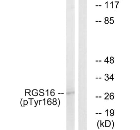 Western Blot - Anti-RGS16 (phospho Tyr168) Antibody (A1232) - Antibodies.com