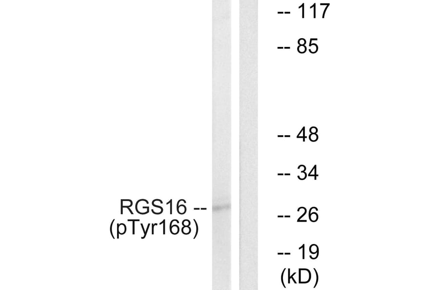 Western Blot - Anti-RGS16 (phospho Tyr168) Antibody (A1232) - Antibodies.com