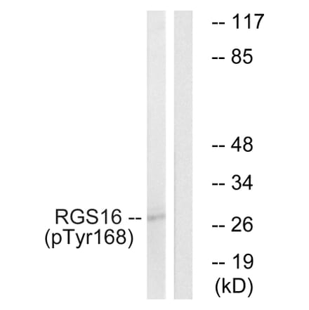 Western Blot - Anti-RGS16 (phospho Tyr168) Antibody (A1232) - Antibodies.com
