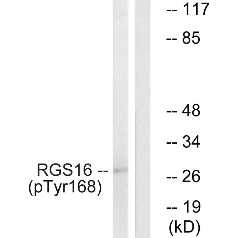 Western Blot - Anti-RGS16 (phospho Tyr168) Antibody (A1232) - Antibodies.com