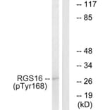 Western Blot - Anti-RGS16 (phospho Tyr168) Antibody (A1232) - Antibodies.com