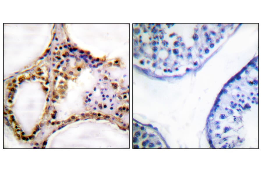 Immunohistochemistry - Anti-RAD52 (phospho Tyr104) Antibody (A1119) - Antibodies.com