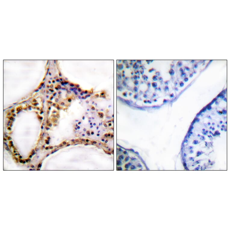 Immunohistochemistry - Anti-RAD52 (phospho Tyr104) Antibody (A1119) - Antibodies.com