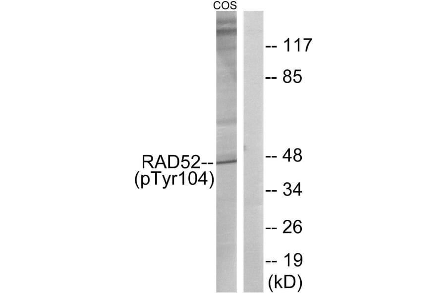 Western Blot - Anti-RAD52 (phospho Tyr104) Antibody (A1119) - Antibodies.com