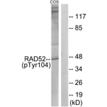 Western Blot - Anti-RAD52 (phospho Tyr104) Antibody (A1119) - Antibodies.com
