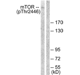 Western Blot - Anti-mTOR (phospho Thr2446) Antibody (A1156) - Antibodies.com