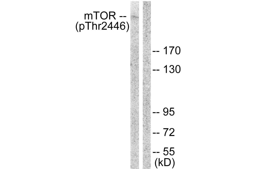 Western Blot - Anti-mTOR (phospho Thr2446) Antibody (A1156) - Antibodies.com
