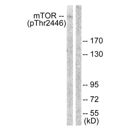 Western Blot - Anti-mTOR (phospho Thr2446) Antibody (A1156) - Antibodies.com