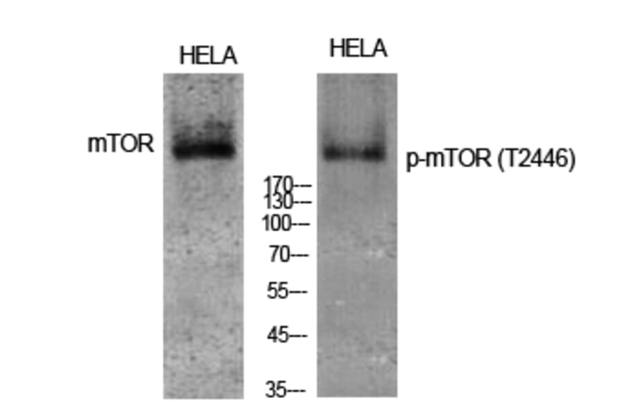 Western Blot - Anti-mTOR (phospho Thr2446) Antibody (A1156) - Antibodies.com