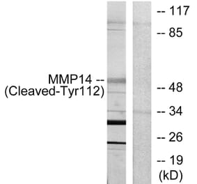 Western Blot - Anti-MMP14 (cleaved Tyr112) Antibody (L0322) - Antibodies.com