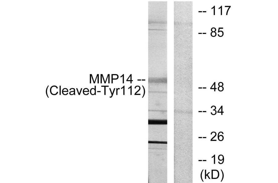 Western Blot - Anti-MMP14 (cleaved Tyr112) Antibody (L0322) - Antibodies.com