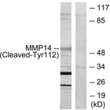 Western Blot - Anti-MMP14 (cleaved Tyr112) Antibody (L0322) - Antibodies.com