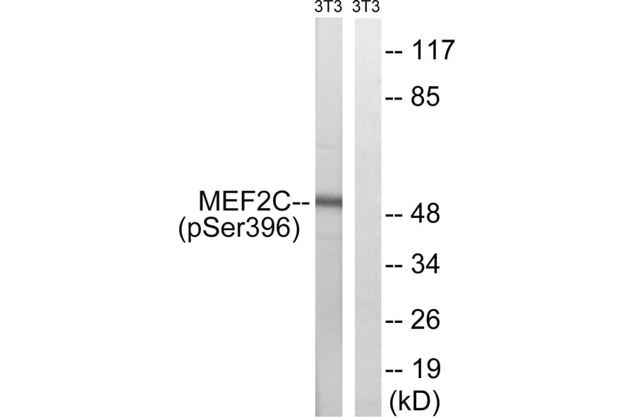 Western Blot - Anti-MEF2C (phospho Ser396) Antibody (A8370) - Antibodies.com
