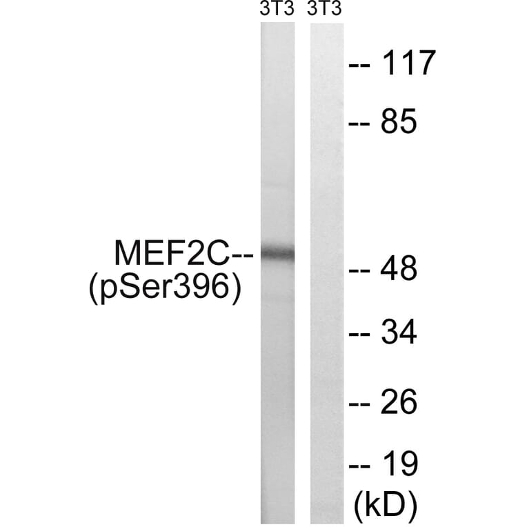 Western Blot - Anti-MEF2C (phospho Ser396) Antibody (A8370) - Antibodies.com