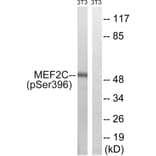 Western Blot - Anti-MEF2C (phospho Ser396) Antibody (A8370) - Antibodies.com