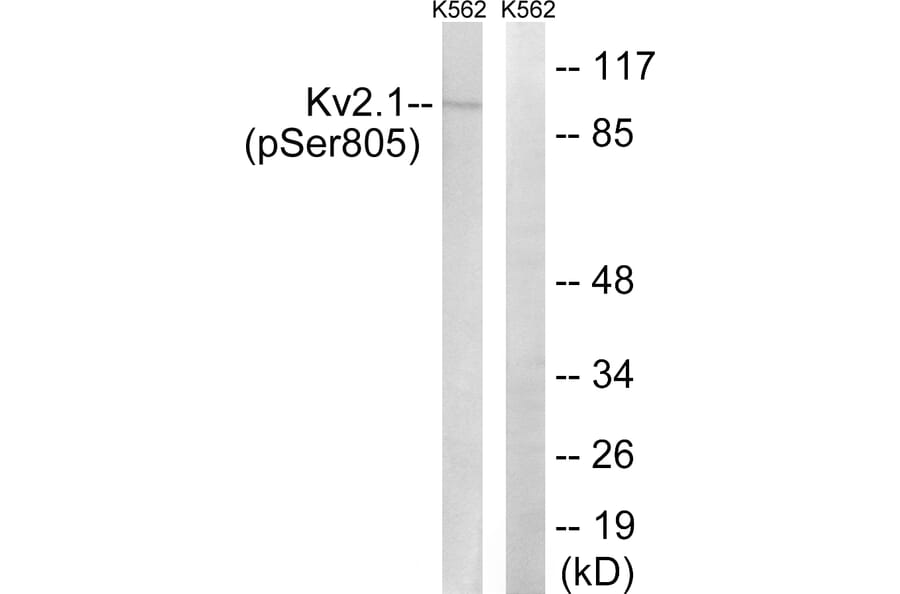 Western Blot - Anti-Kv2.1 (phospho Ser805) Antibody (A8358) - Antibodies.com
