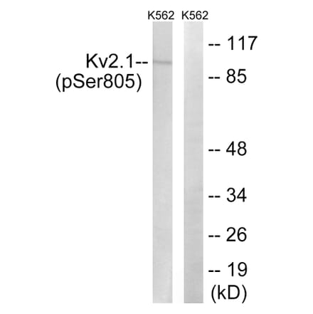 Western Blot - Anti-Kv2.1 (phospho Ser805) Antibody (A8358) - Antibodies.com
