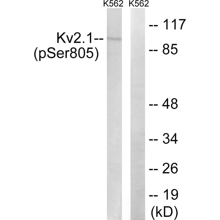 Western Blot - Anti-Kv2.1 (phospho Ser805) Antibody (A8358) - Antibodies.com