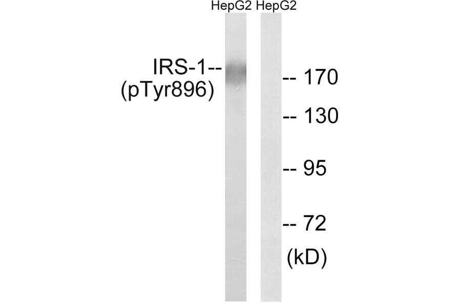 Western Blot - Anti-IRS-1 (phospho Tyr896) Antibody (A8220) - Antibodies.com