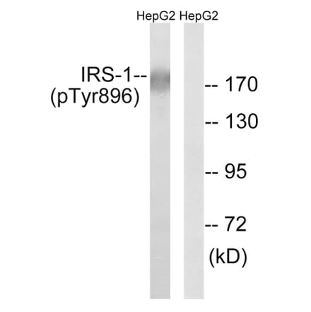 Western Blot - Anti-IRS-1 (phospho Tyr896) Antibody (A8220) - Antibodies.com
