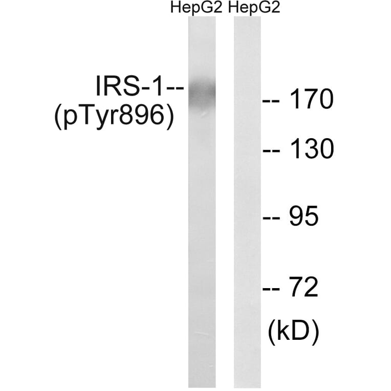 Western Blot - Anti-IRS-1 (phospho Tyr896) Antibody (A8220) - Antibodies.com