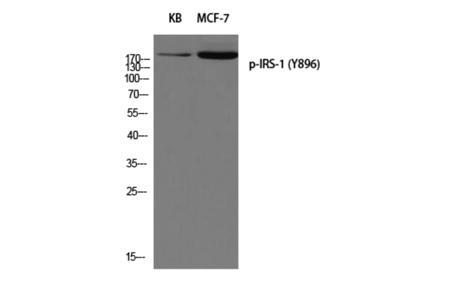 Western Blot - Anti-IRS-1 (phospho Tyr896) Antibody (A8220) - Antibodies.com