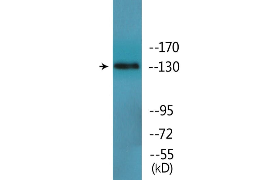 Western Blot - Anti-IRS-1 (phospho Tyr896) Antibody (P12-1126) - Antibodies.com