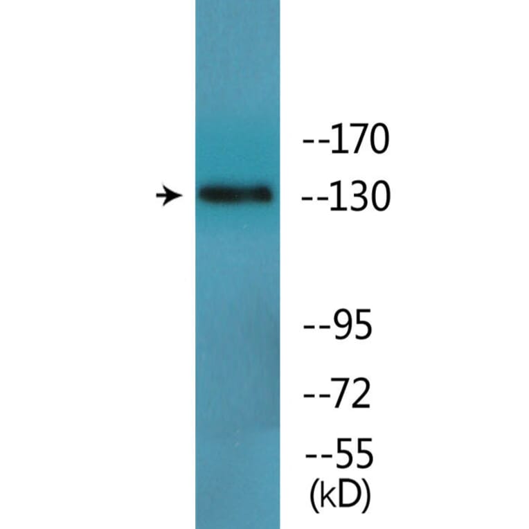 Western Blot - Anti-IRS-1 (phospho Tyr896) Antibody (P12-1126) - Antibodies.com