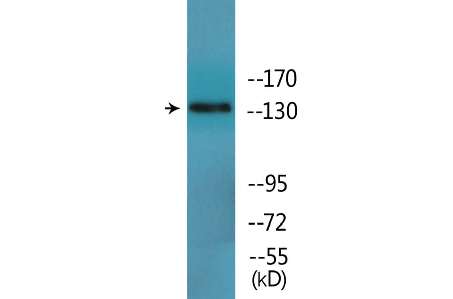 Western Blot - Anti-IRS-1 (phospho Ser312) Antibody (P12-1125) - Antibodies.com