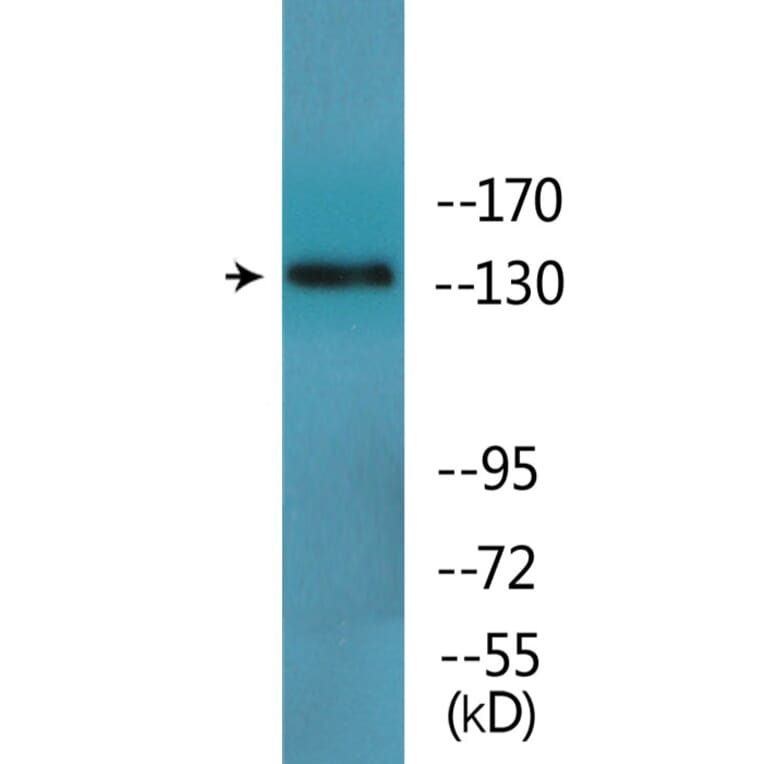 Western Blot - Anti-IRS-1 (phospho Ser312) Antibody (P12-1125) - Antibodies.com