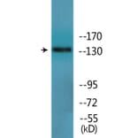 Western Blot - Anti-IRS-1 (phospho Ser312) Antibody (P12-1125) - Antibodies.com
