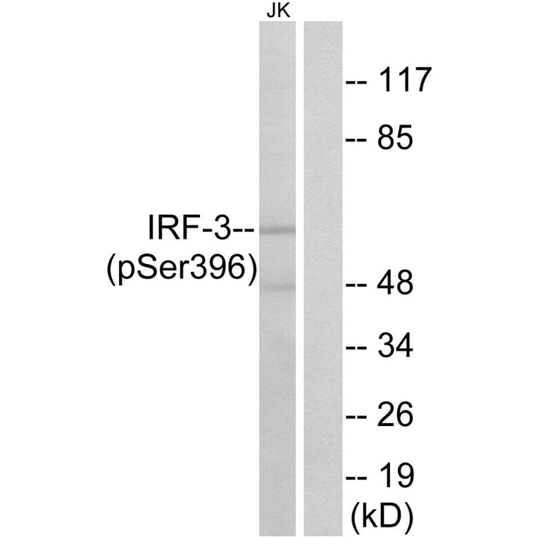 Western Blot - Anti-IRF-3 (phospho Ser396) Antibody (A0667) - Antibodies.com