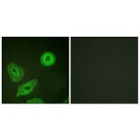 Immunofluorescence - Anti-HER3 (phospho Tyr1289) Antibody (A0945) - Antibodies.com