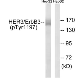 Western Blot - Anti-HER3 (phospho Tyr1197) Antibody (A8460) - Antibodies.com