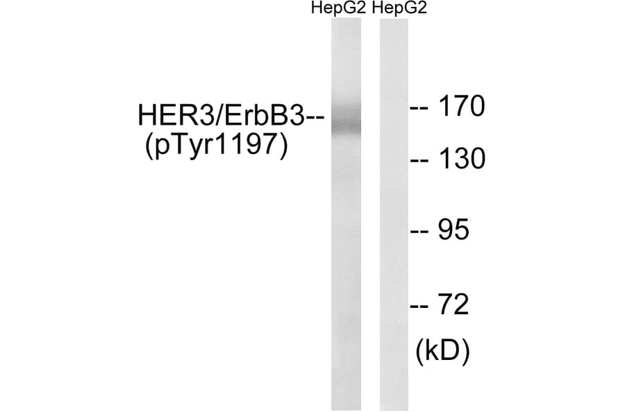 Western Blot - Anti-HER3 (phospho Tyr1197) Antibody (A8460) - Antibodies.com