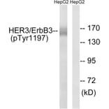 Western Blot - Anti-HER3 (phospho Tyr1197) Antibody (A8460) - Antibodies.com