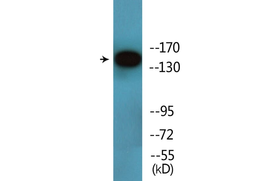 Western Blot - Anti-HER3 (phospho Tyr1197) Antibody (P12-1115) - Antibodies.com