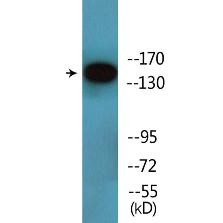 Western Blot - Anti-HER3 (phospho Tyr1197) Antibody (P12-1115) - Antibodies.com