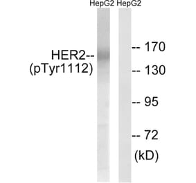 Western Blot - Anti-HER2 (phospho Tyr1112) Antibody (A8039) - Antibodies.com