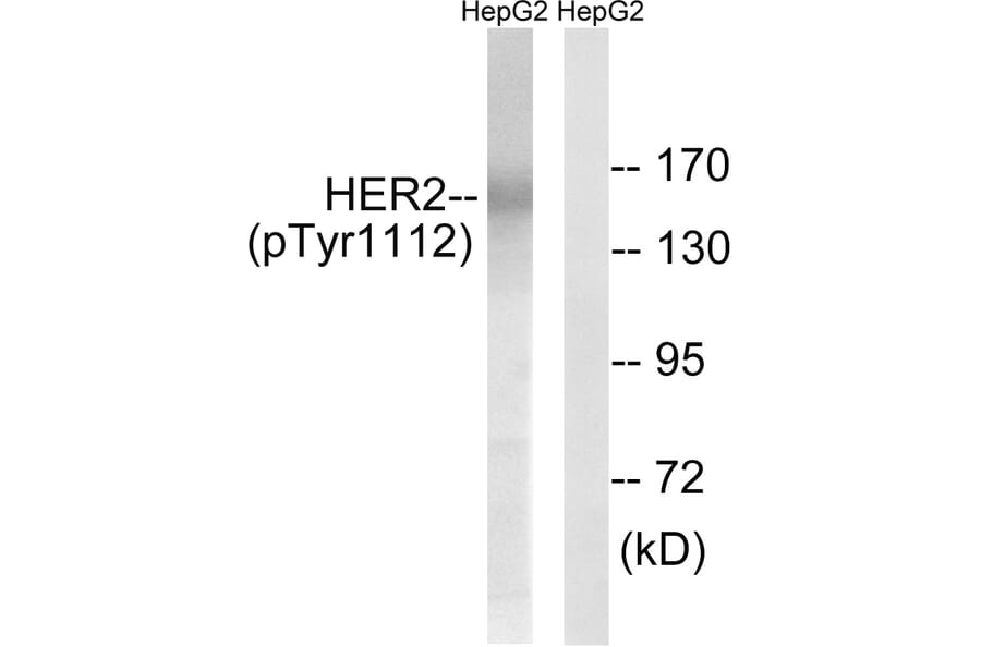Western Blot - Anti-HER2 (phospho Tyr1112) Antibody (A8039) - Antibodies.com