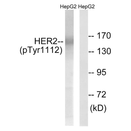Western Blot - Anti-HER2 (phospho Tyr1112) Antibody (A8039) - Antibodies.com