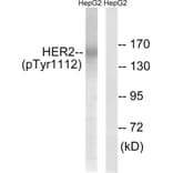 Western Blot - Anti-HER2 (phospho Tyr1112) Antibody (A8039) - Antibodies.com