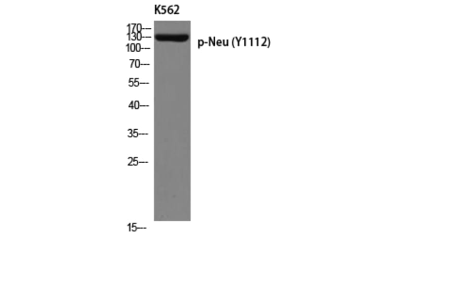Western Blot - Anti-HER2 (phospho Tyr1112) Antibody (A8039) - Antibodies.com
